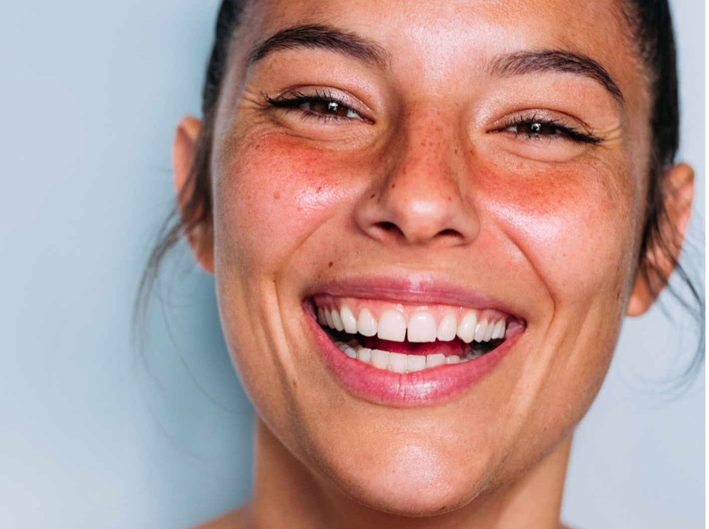 BLIS Q24 Skin Probiotics